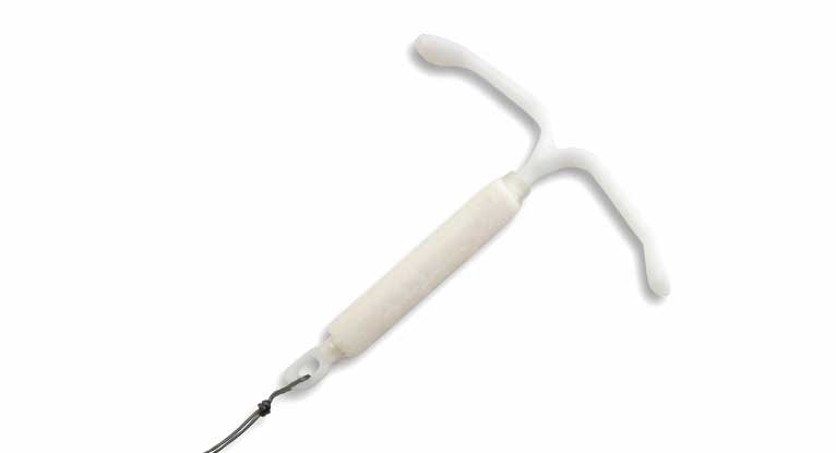 Contraception: Hormonal IUD – Mirena